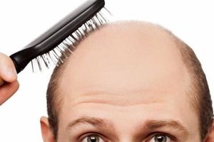 محصول تقویت موی «ب» نباید با ادعای درمانی تبلیغ شود