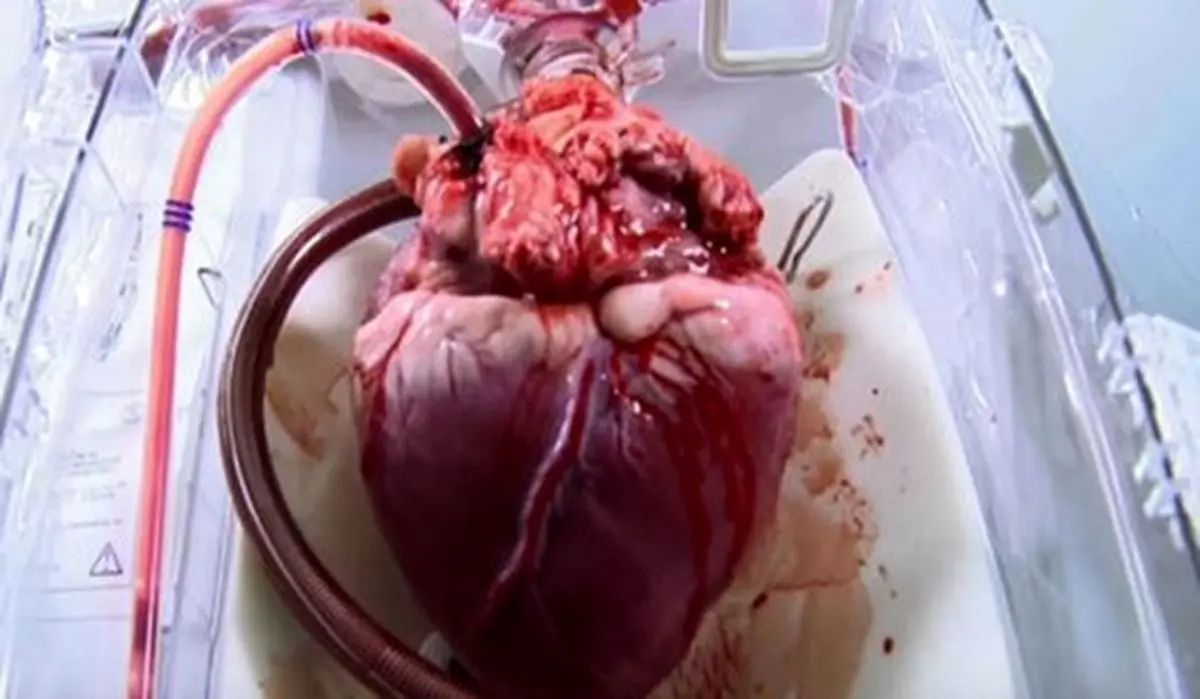 کدام بیماری بیشتر از همه ایرانی‌ها را می‌کشد؟