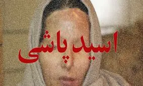 کلیات طرح «تشدید مجازات اسیدپاشی» به تصویب رسید
