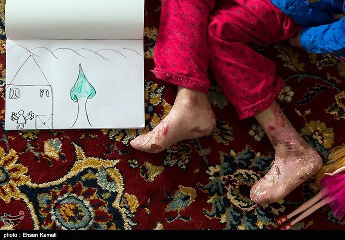 چهار استانی که بیشترین بیماری‌ مادرزادی را دارند
