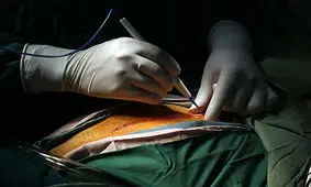 جراحی لاغری و پیکر تراشی چه عوارضی دارد؟