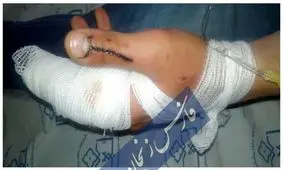 دانشجوی زنجانی قربانی جدید سهل‌انگاری نگهداری سگ