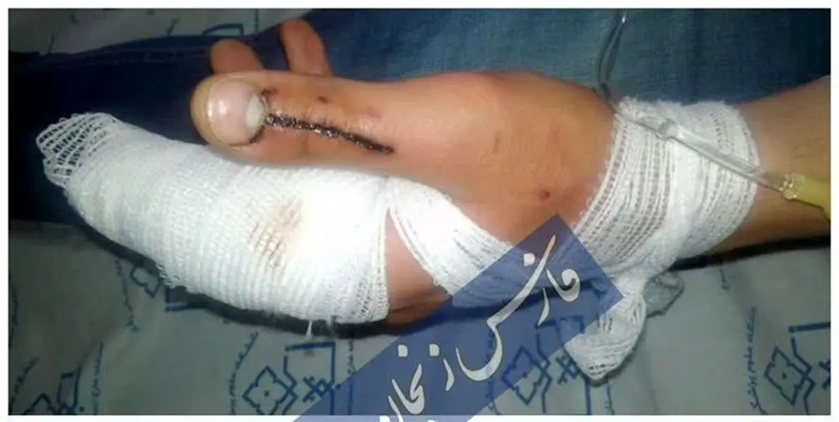 دانشجوی زنجانی قربانی جدید سهل‌انگاری نگهداری سگ