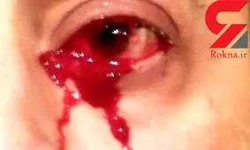 خون گریه کردن مرد ایتالیایی