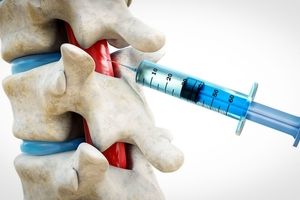 امکان ترمیم اعصاب نخاع با تزریق یک دوز ژل نانویی

