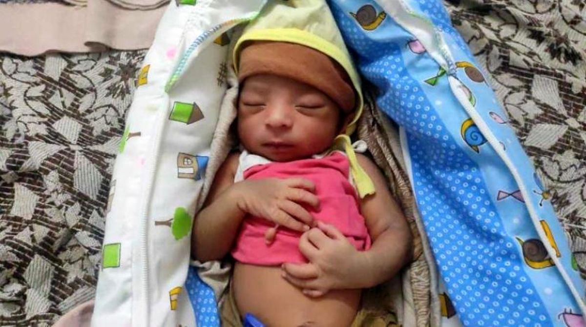  تولد نوزادی با ۲۴ انگشت در هند/ تصویر