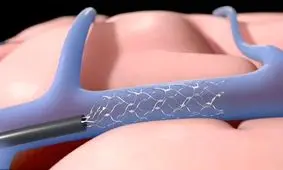 پیدا شدن یک رقیب برای تراشه مغزی "ایلان ماسک"!

