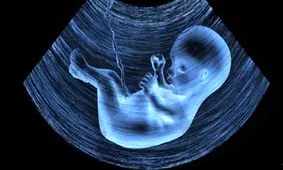 غربالگری مادران باردار حذف شده است؟/ ویدئو