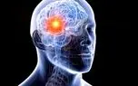 هوش مصنوعی جدید با تحلیل DNA می‌تواند ریسک سکته مغزی را پیش بینی کند