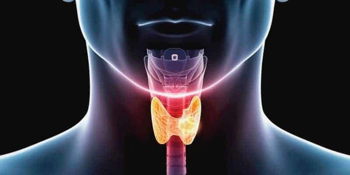 برخی خوراکی ها صدای شما را زیبا میکند