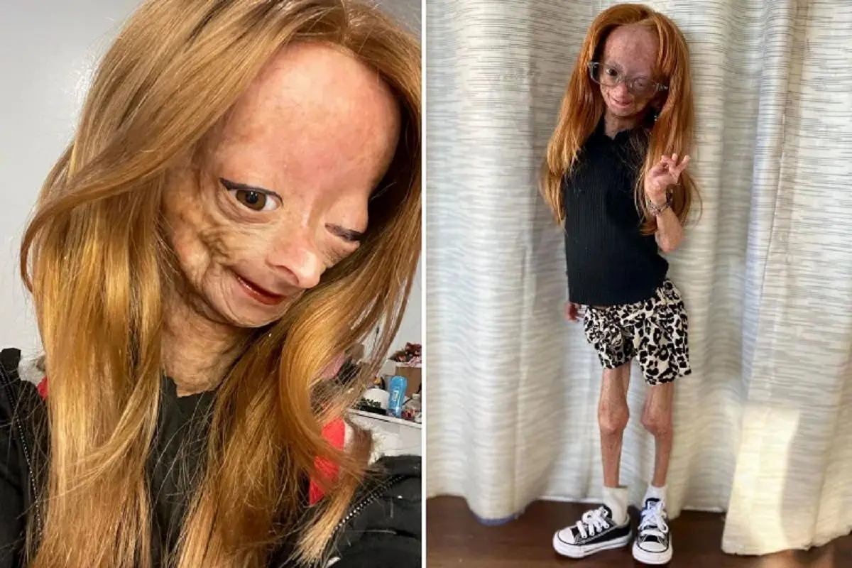 آدالیا رُز ویلیامز، ستاره محبوب یوتیوب و بنجامین باتنِ دنیای واقعی در ۱۵ سالگی درگذشت