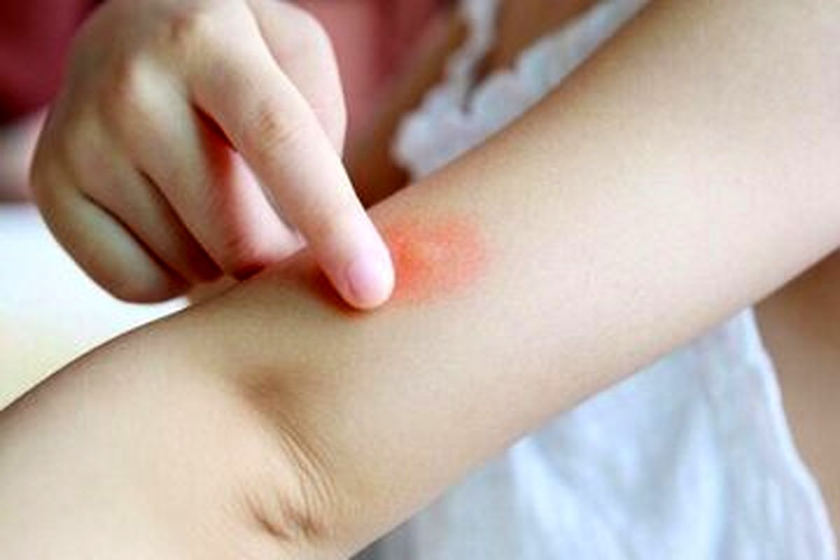 هشدار وزارت بهداشت درباره یک حشره خطرناک