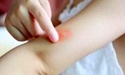 هشدار وزارت بهداشت درباره یک حشره خطرناک