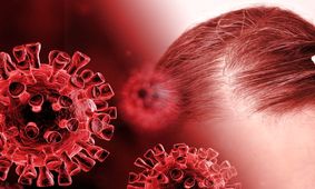 ریزش مو سه ماه بعد از کرونا شروع می شود/ میزان ریزش با شدت بیماری ارتباط مستقیم دارد
