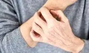 توصیه های طب ایرانی برای محافظت از پوست در برابر استرس جنگ