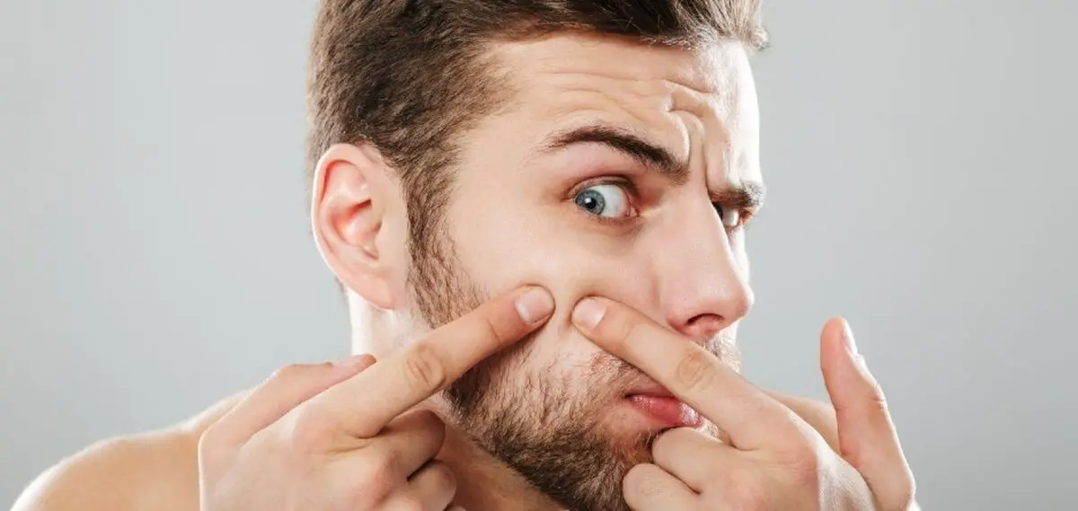 بهترین روتین پوستی برای از بین بردن جوش ‌های سر سیاه