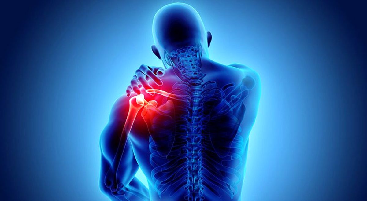 علت ابتلا، علائم، تشخیص و درمان تاندونیت