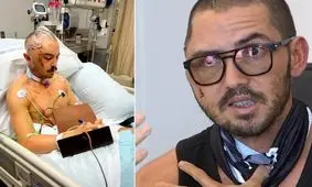 تمساح جمجمه یک شناگر را له کرد!/ عکس
