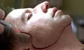 تغییر چهره با ۲۴ میلیون دلار!/ ویدئو