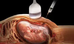 آقای وزارت بهداشت، بخشنامه  جدید غربالگری، حلاف قسم نامه پزشکی است