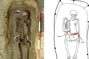 کشف اسکلت و اندام مصنوعی در گورستان قرون وسطایی/ عکس