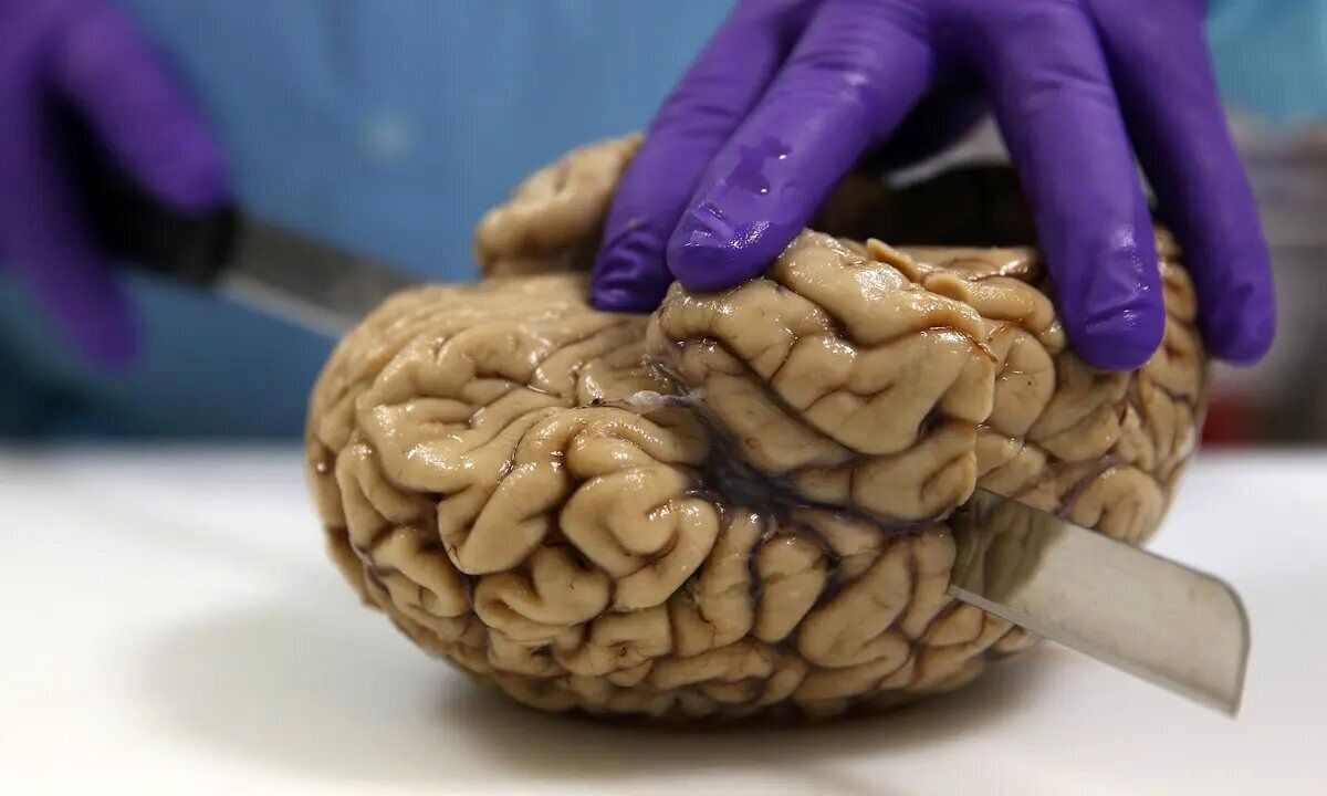 جزئی‌ترین تصویر از مغز انسان که تابه‌حال دیده‌اید