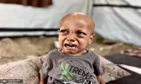 شهادت کودک فلسطینی در سایه گرسنگی در غزه/ ویدئو