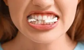 رابطه شگفت انگیز جویدن و دیابت نوع ۲