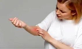 علت و درمان خارش پوست بعد از حمام