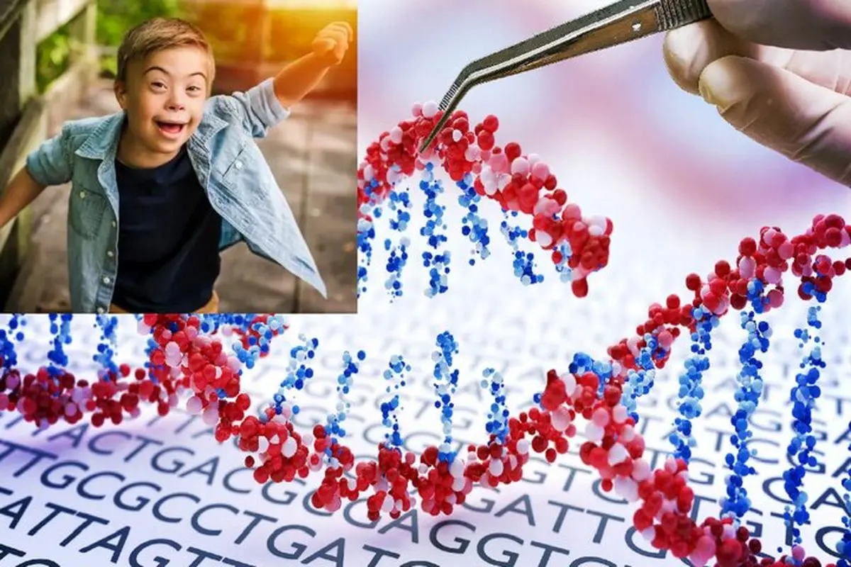 گام جسورانه فناوری کریسپر برای خاموش کردن کلید سندرم داون