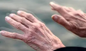 علائم ابتدایی پارکینسون را بشناسید