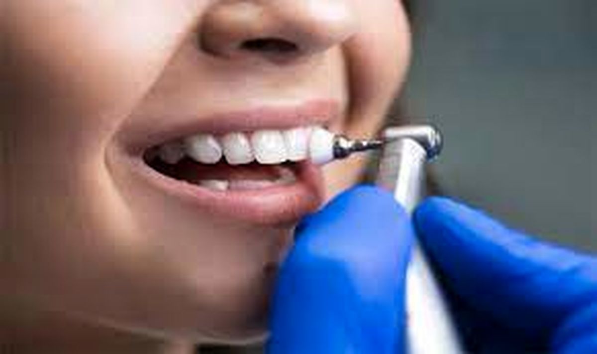 عوارض جرم گیری دندان چیست؟
