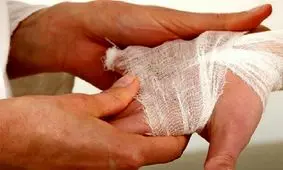 انفجار مواد محترقه و قطع انگشتان نوجوان همدانی