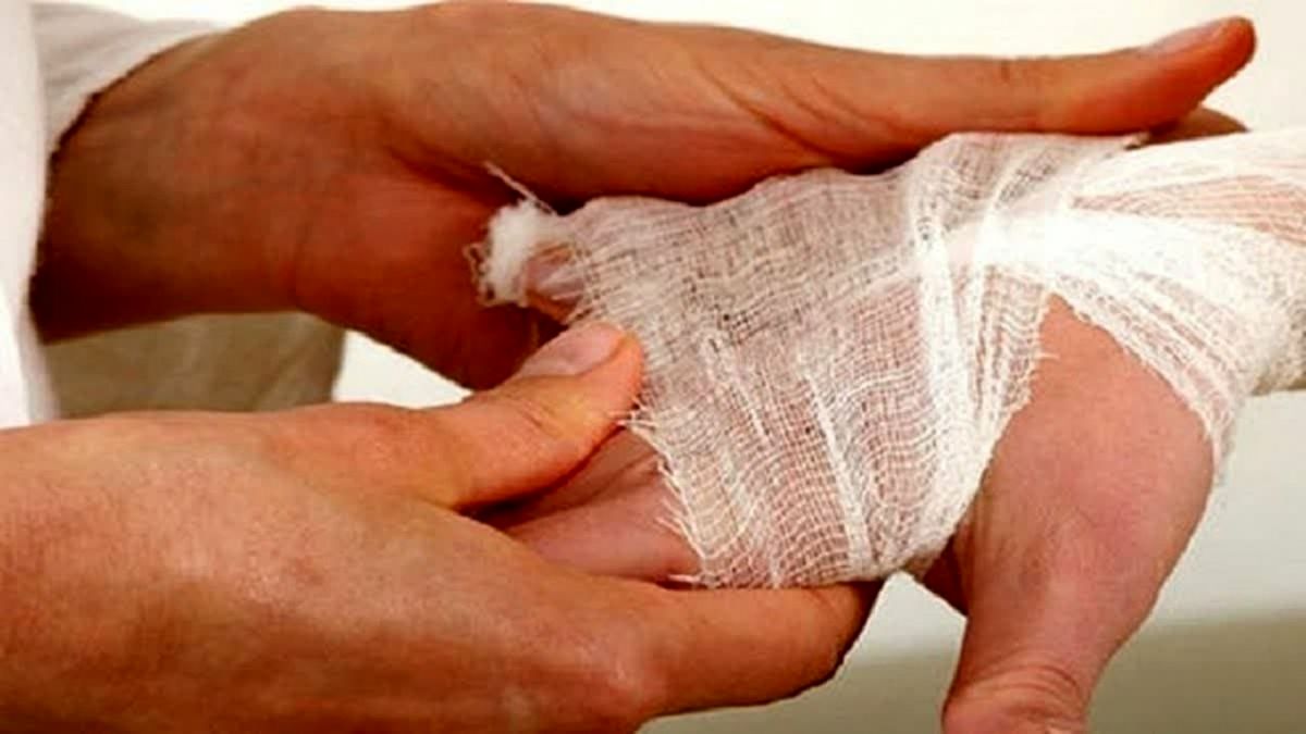 انفجار مواد محترقه و قطع انگشتان نوجوان همدانی
