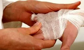 انفجار مواد محترقه و قطع انگشتان نوجوان همدانی