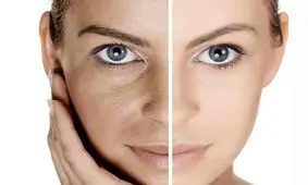 چهار مرحله برای مراقبت از پوست