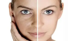 چهار مرحله برای مراقبت از پوست