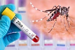ویروس «زیکا» چیست؟/ علائم و نشانه‌های عفونت ویروسی زیکا