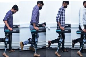 پای مصنوعی هوشمند؛ امیدی تازه برای راه‌ رفتن افراد قطع عضو