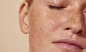 باکتری های عامل آکنه برای پوست سالم حیاتی هستند!