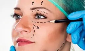 ستاره‌های هالیوود، در مدتِ اعتصاب بازیگران و نویسندگان، فرصت را برای جراحی‌های زیبایی، غنیمت شمرده‌اند