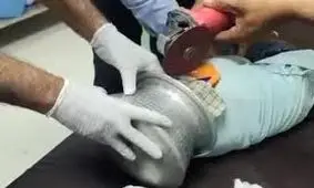 لحظه نفسگیر نجات خردسالی که سرش در قابلمه گیر کرده/ ویدئو