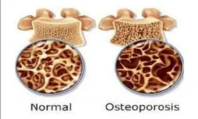 رصد جهت گیری تغذیه ای جامعه؛ چالش ها و رهیافت ها