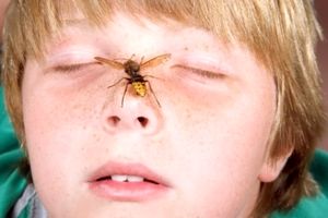 نیش زنبور در کودکان چه علائمی دارد و چه باید کرد؟