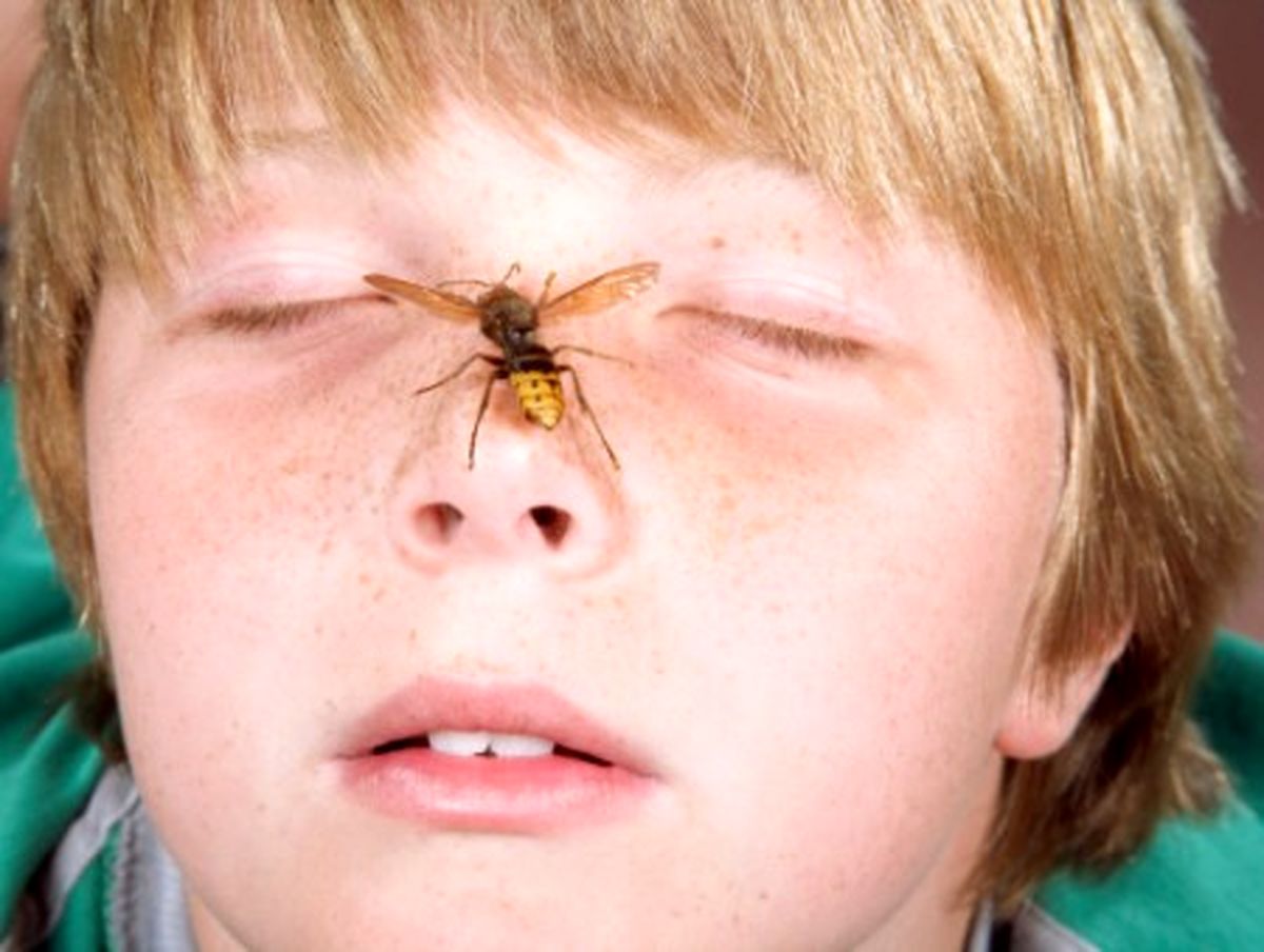 نیش زنبور در کودکان چه علائمی دارد و چه باید کرد؟