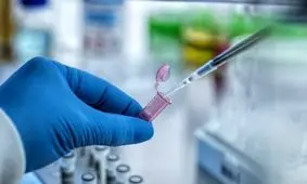 طراحی دقیق‌ترین آزمایش برای بررسی پیری بیولوژیکی

