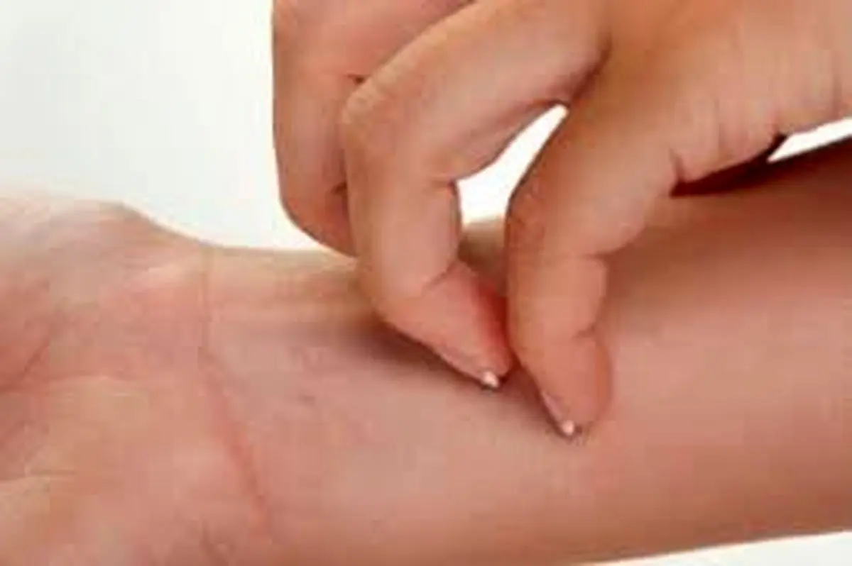 چرا برخی مواد غذایی حساسیت زا می شوند؟