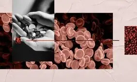 توصیه هایی برای بهبود جریان خون؛ از ویتامین تا سبک زندگی