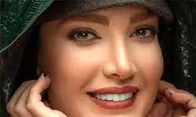 از عاشقانه همسر متین تا کاشت موی احسان کرمی