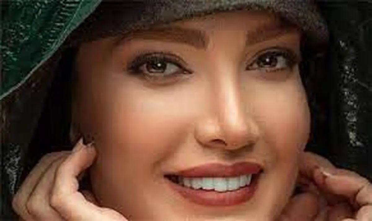 از عاشقانه همسر متین تا کاشت موی احسان کرمی